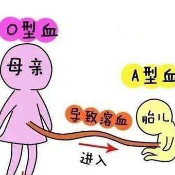 ABO溶血宝宝会贫血吗