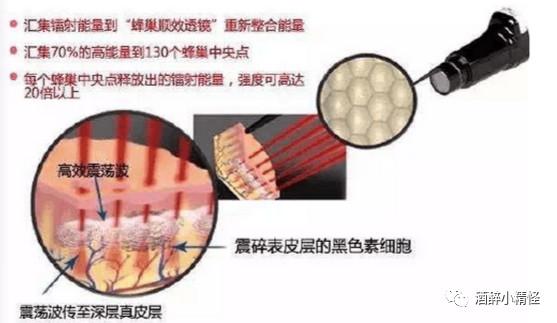 皮秒超皮秒激光区别