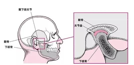 下巴脱臼什么症状表现