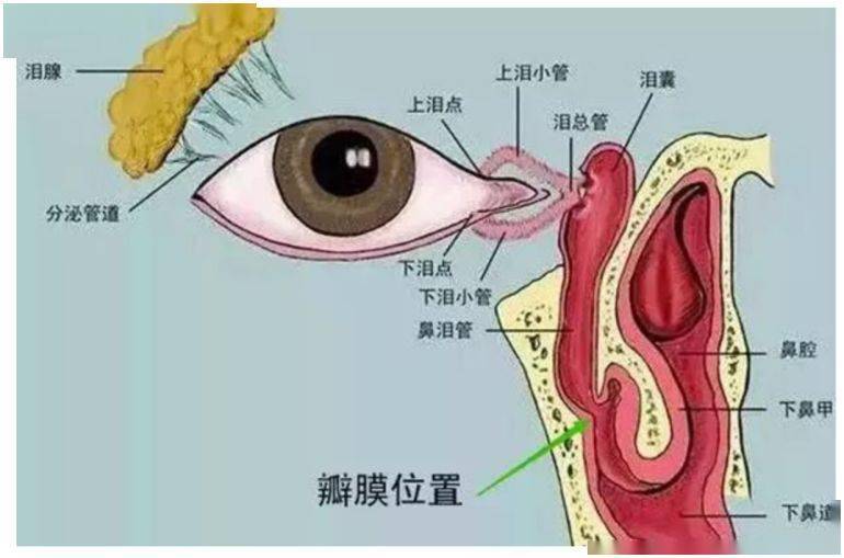 泪道堵塞用什么眼药水最有效