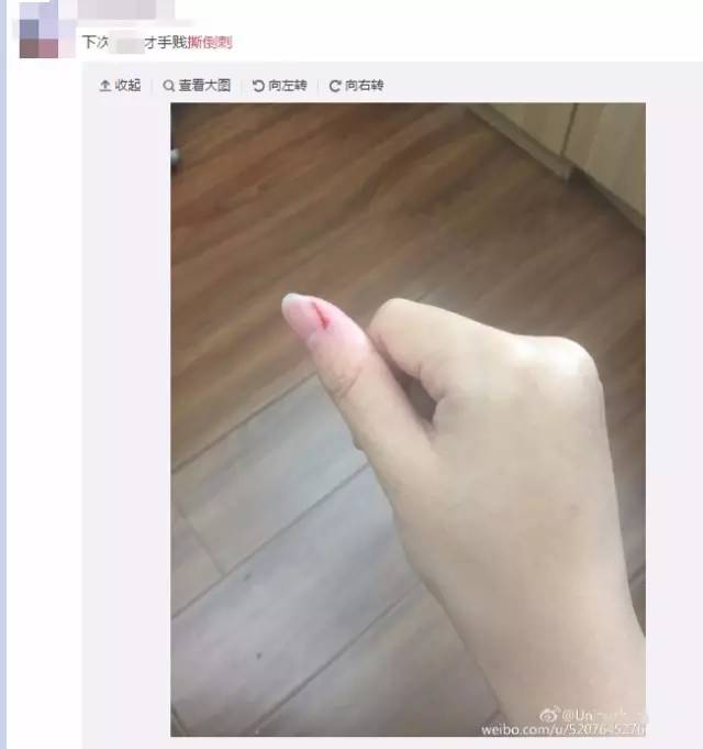 女友咬手